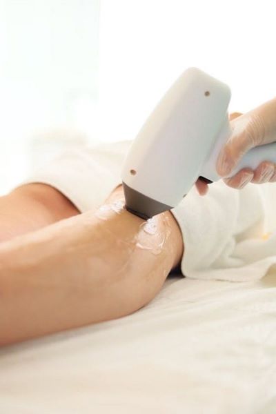 Lasersko odstranjevanje dlak